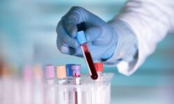 تاثیر آزمایش خون مبتنی بر DNA بر درمان سرطان گلو