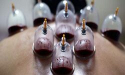 حجامت توسط افراد غیر متخصص خطرناک است