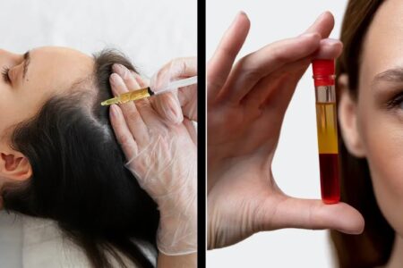 پی آر پی مو چند درصد جواب می‌دهد؟ بررسی علمی اثربخشی PRP برای ریزش مو